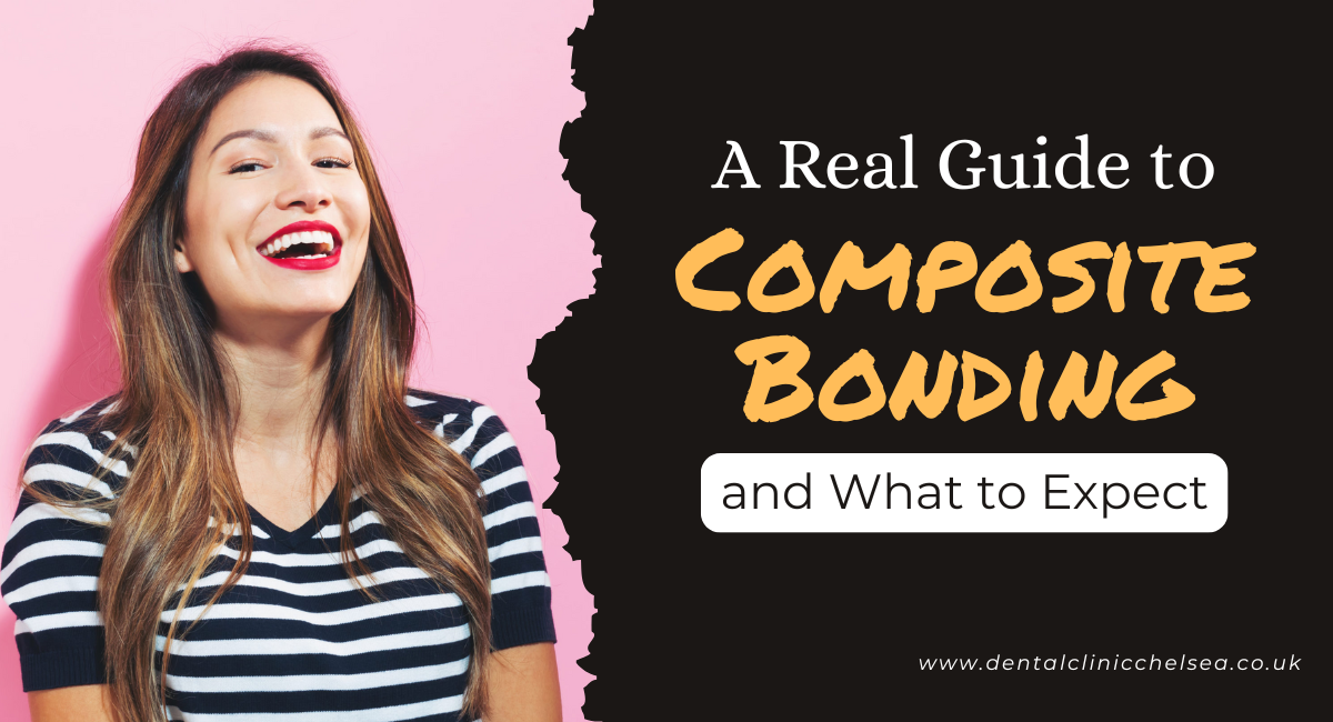 Composite Bonding Cost in London