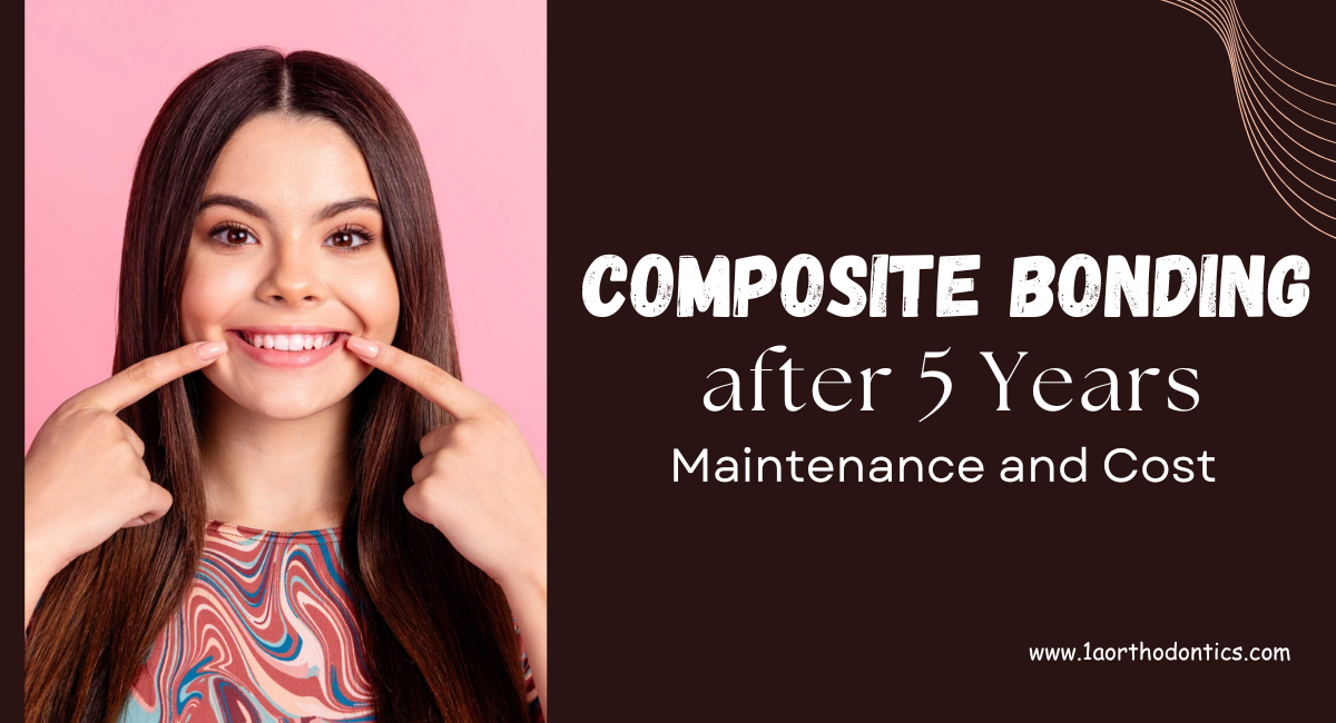 Composite Bonding Price in London