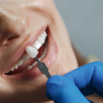 dental implants yuba city